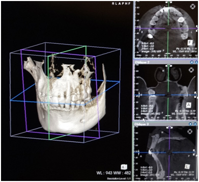 目黒区、都立大学の歯医者、あさの歯科クリニック