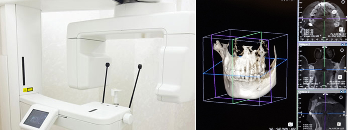 目黒区、都立大学の歯医者、あさの歯科クリニック