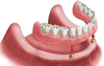 目黒区、都立大学の歯医者、あさの歯科クリニック