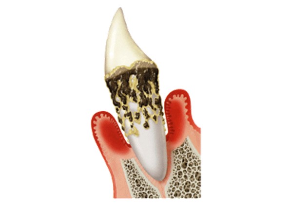 目黒区、都立大学の歯医者、あさの歯科クリニック